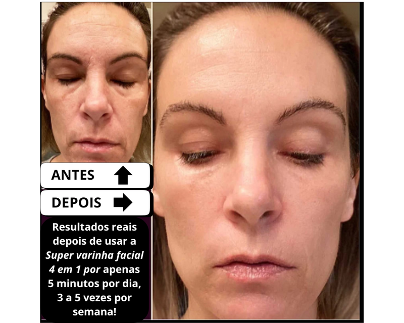 Super Varinha Facial 4 em 1 : Microcorrente, luz vermelha, massagem facial e calor terapêutico. Rejuvenesce, firma e suaviza a pele, promovendo uma aparência radiante e saudável com um único dispositivo.